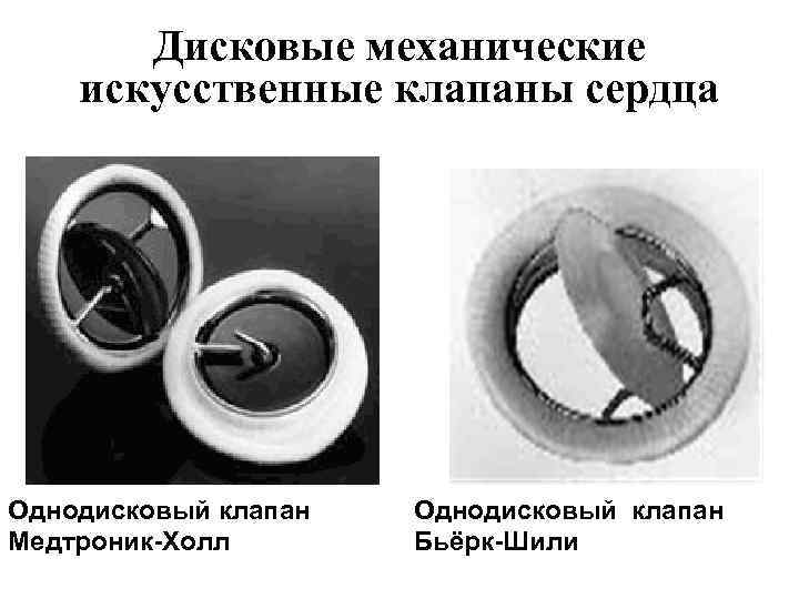 Дисковые механические искусственные клапаны сердца Однодисковый клапан Медтроник-Холл Однодисковый клапан Бьёрк-Шили 