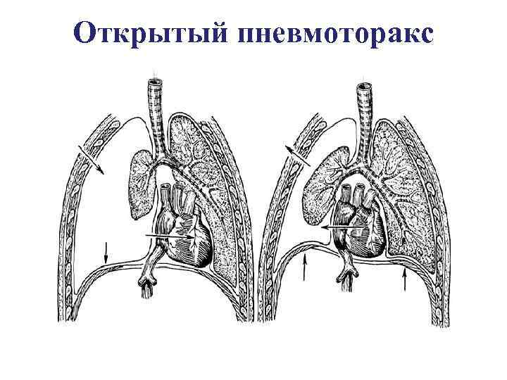 Конусовидная форма груди фото