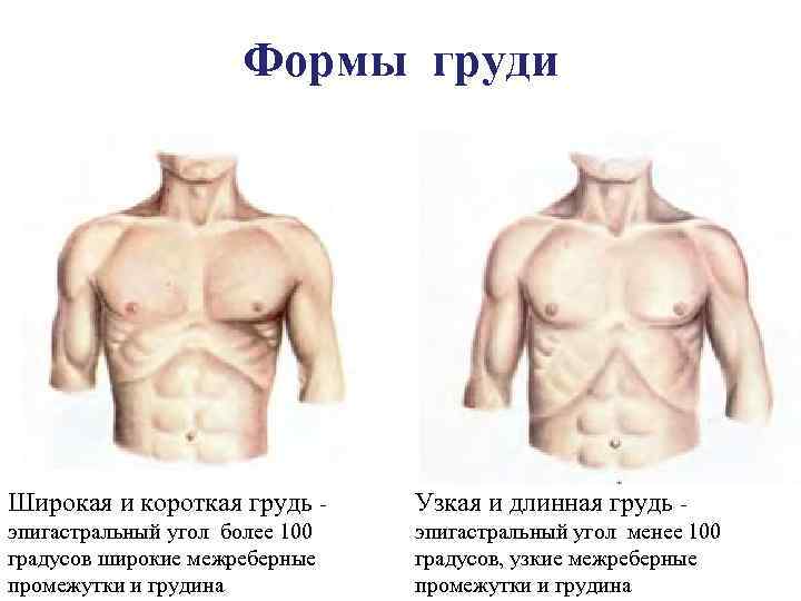 Формы груди Широкая и короткая грудь Узкая и длинная грудь эпигастральный угол более 100