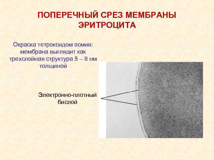 ПОПЕРЕЧНЫЙ СРЕЗ МЕМБРАНЫ ЭРИТРОЦИТА Окраска тетроксидом осмия: мембрана выглядит как трехслойная структура 5 –