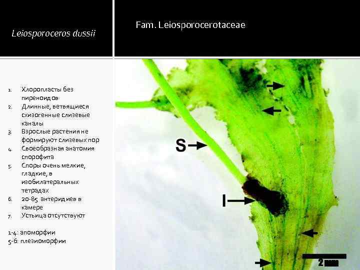 Leiosporoceros dussii 1. 2. 3. 4. 5. 6. 7. Fam. Leiosporocerotaceae Хлоропласты без пиреноидов