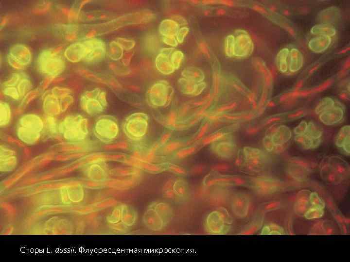 Споры L. dussii. Флуоресцентная микроскопия. 