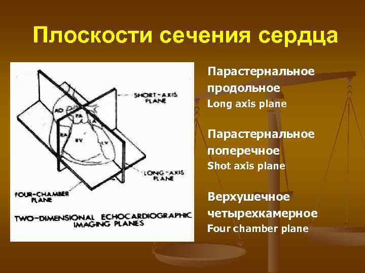 Плоскости сечения сердца Парастернальное продольное Long axis plane Парастернальное поперечное Shot axis plane Верхушечное