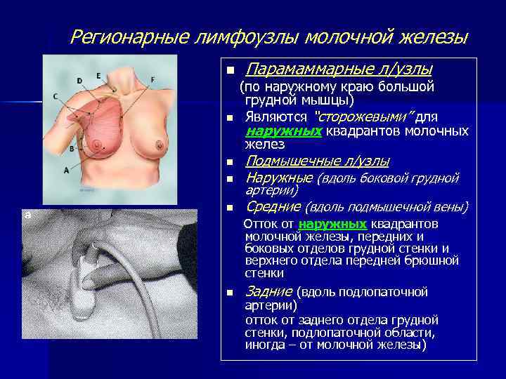 Регионарные лимфоузлы молочной железы n n Парамаммарные л/узлы (по наружному краю большой грудной мышцы)