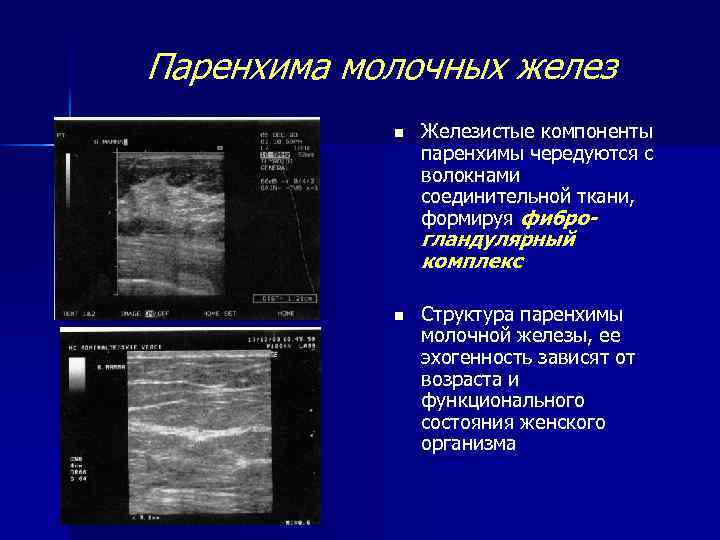 Паренхима молочных желез n Железистые компоненты паренхимы чередуются с волокнами соединительной ткани, формируя фибро-