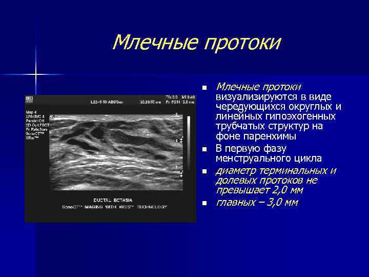 Млечные протоки n n Млечные протоки визуализируются в виде чередующихся округлых и линейных гипоэхогенных