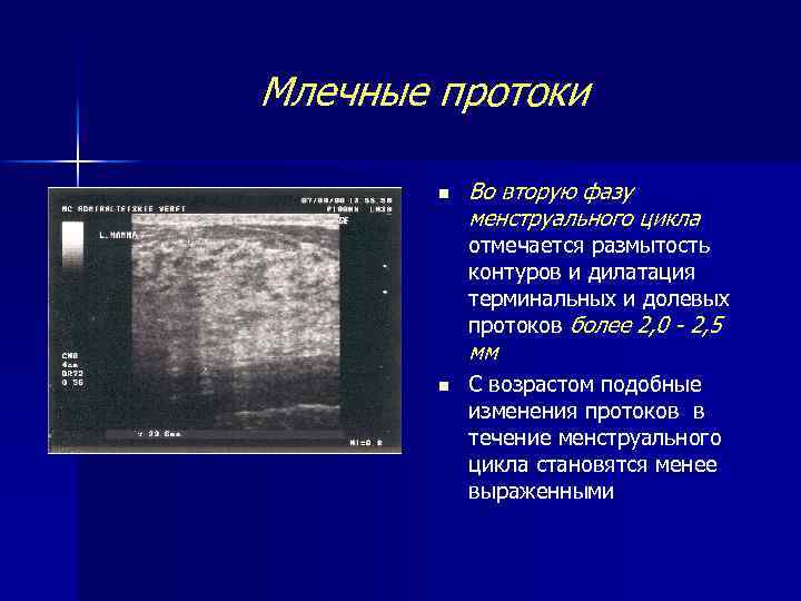 Млечные протоки n Во вторую фазу менструального цикла отмечается размытость контуров и дилатация терминальных