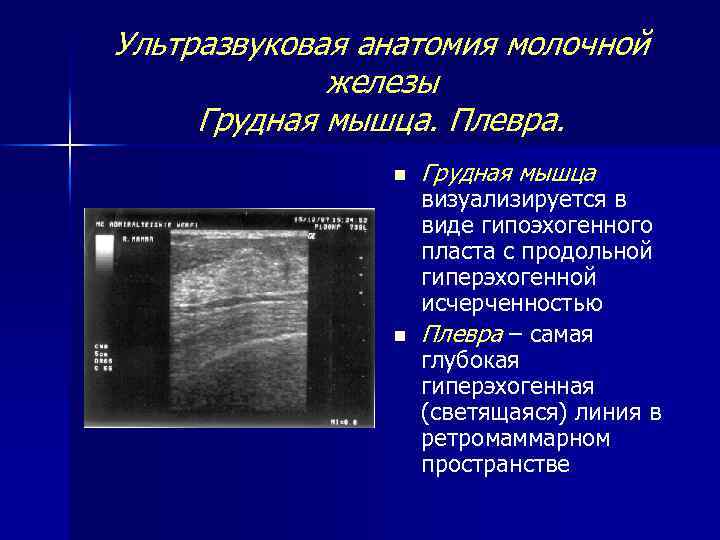 Ультразвуковая анатомия молочной железы Грудная мышца. Плевра. n n Грудная мышца визуализируется в виде