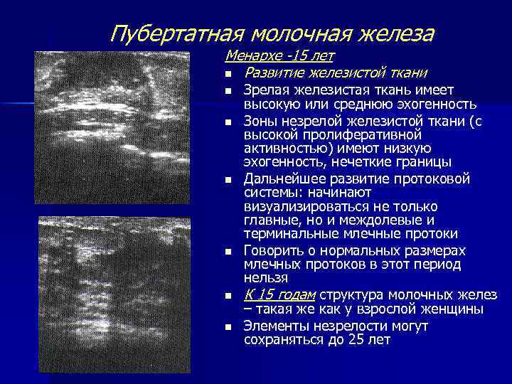 Пубертатная молочная железа Менархе -15 лет n Развитие железистой ткани n n n Зрелая