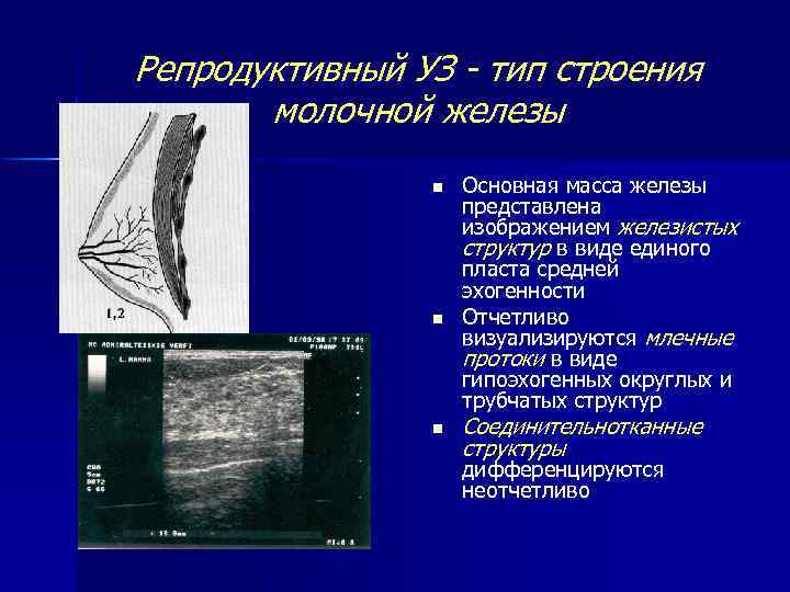 Схема строения иона железа 3