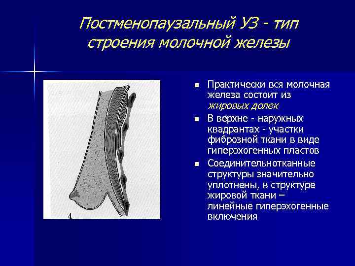 Постменопаузальный УЗ - тип строения молочной железы n Практически вся молочная железа состоит из