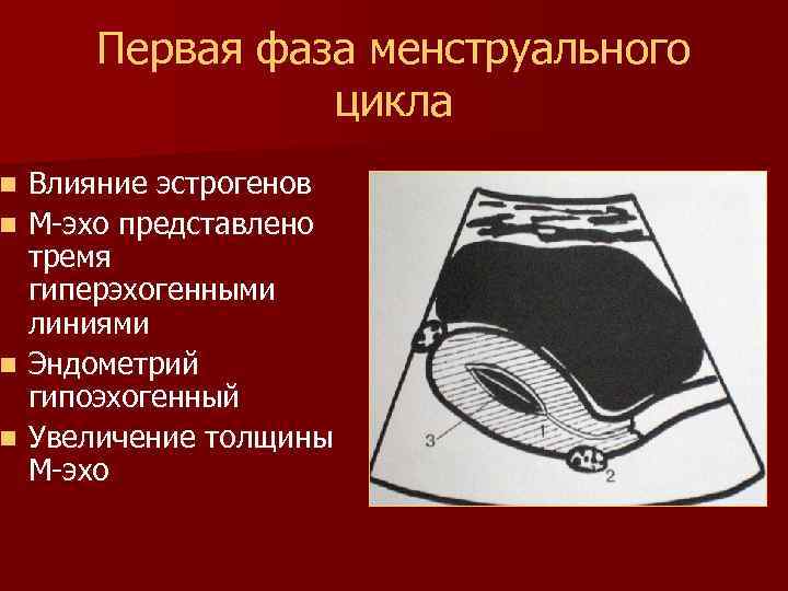 Первая фаза менструального цикла Влияние эстрогенов n М-эхо представлено тремя гиперэхогенными линиями n Эндометрий