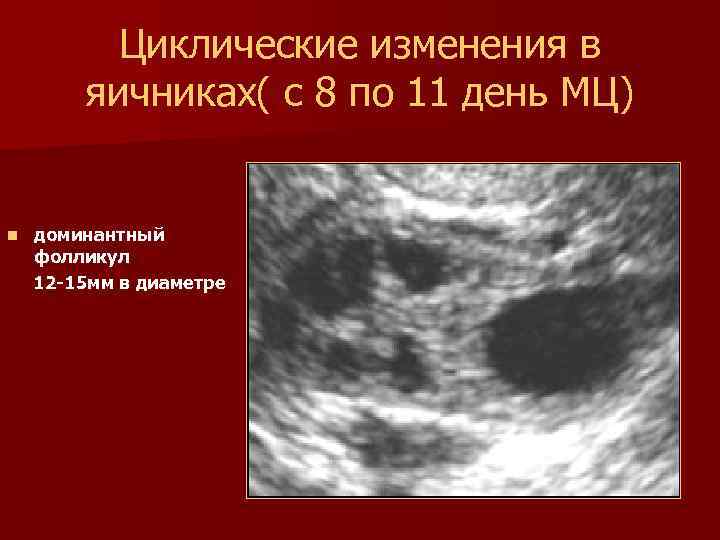 Циклические изменения в яичниках( с 8 по 11 день МЦ) n доминантный фолликул 12