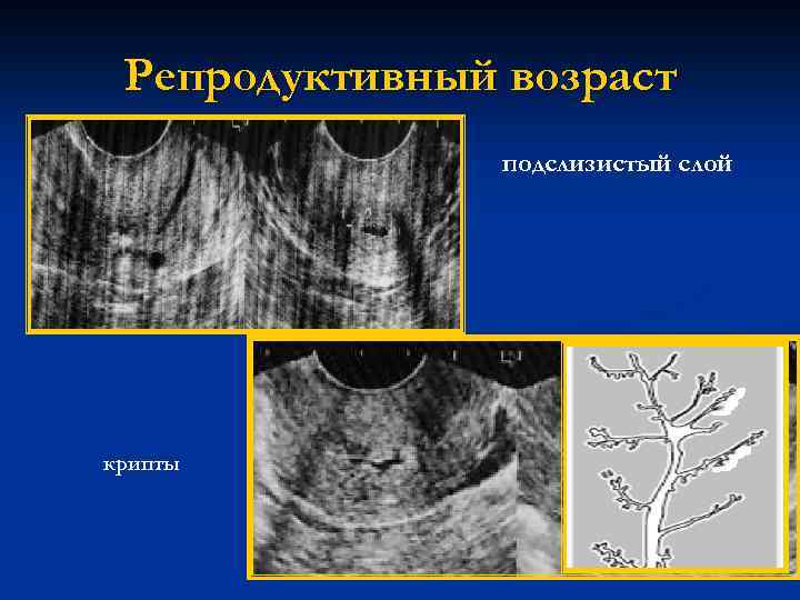 Цитологическая картина коллоидного узла bethesda ii