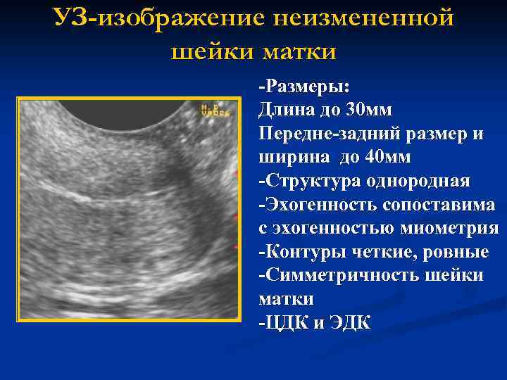 Эндометрий 1 3. Размер тела матки норма по УЗИ мм. Эхогенность миометрия. Размеры шейки матки на УЗИ норма. Нормальные параметры матки.