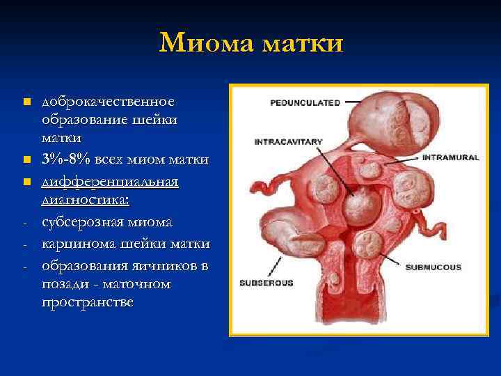 Образование на шейке матки фото