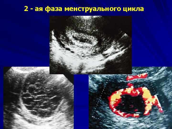 2 - ая фаза менструального цикла 