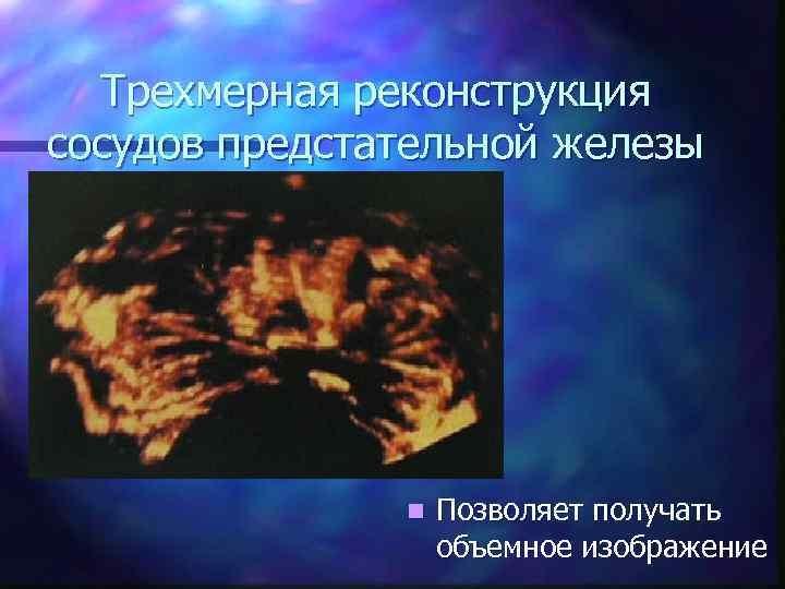 Трехмерная реконструкция сосудов предстательной железы n Позволяет получать объемное изображение 
