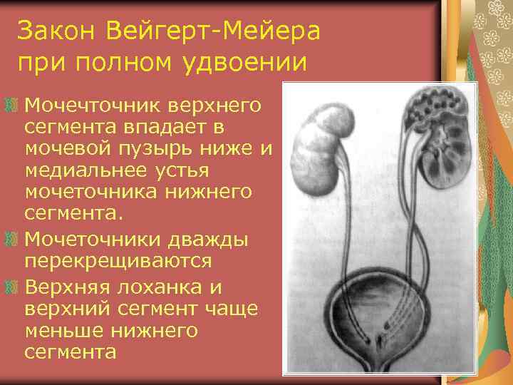 Закон Вейгерт-Мейера при полном удвоении Мочечточник верхнего сегмента впадает в мочевой пузырь ниже и
