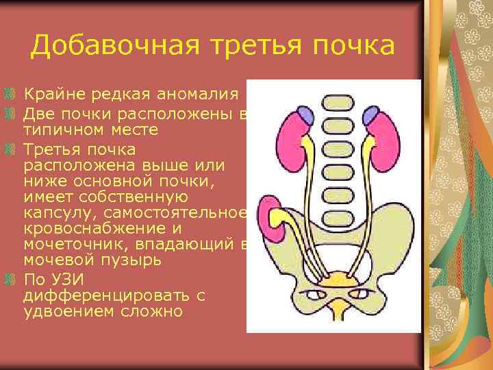 Добавочная третья почка Крайне редкая аномалия Две почки расположены в типичном месте Третья почка