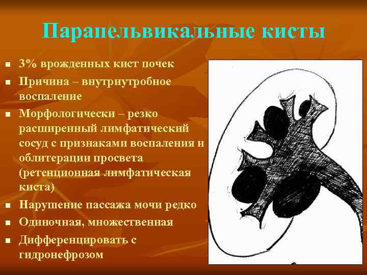Парапельвикальные кисты n n n 3% врожденных кист почек Причина – внутриутробное воспаление Морфологически