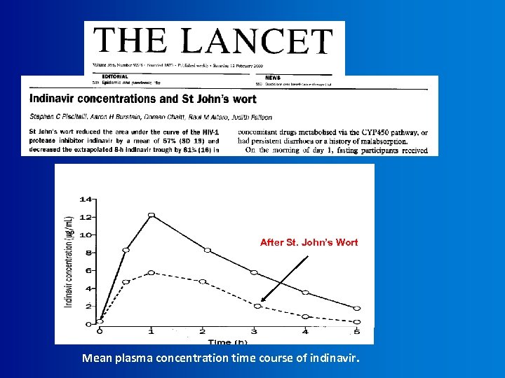 After St. John’s Wort Mean plasma concentration time course of indinavir. 