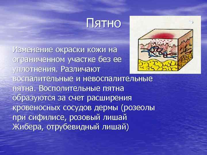 Пятно Изменение окраски кожи на ограниченном участке без ее уплотнения. Различают воспалительные и невоспалительные