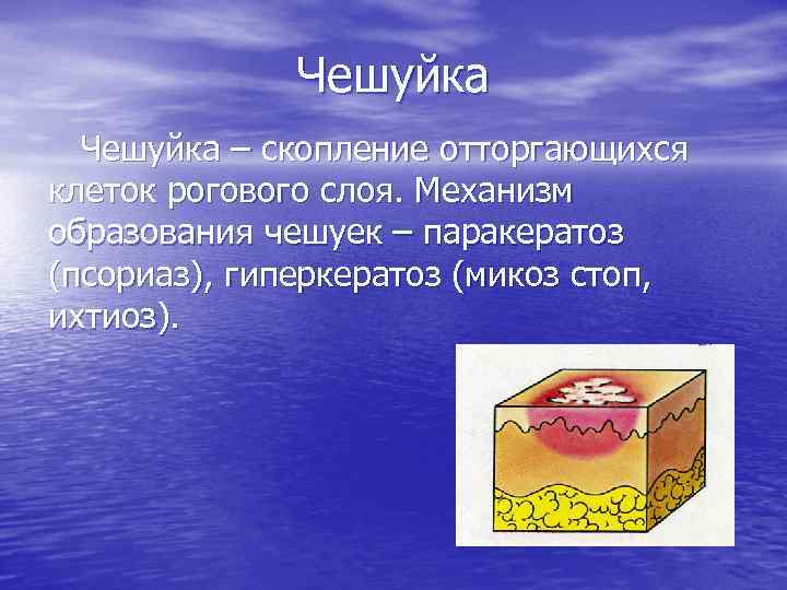 Чешуйка – скопление отторгающихся клеток рогового слоя. Механизм образования чешуек – паракератоз (псориаз), гиперкератоз