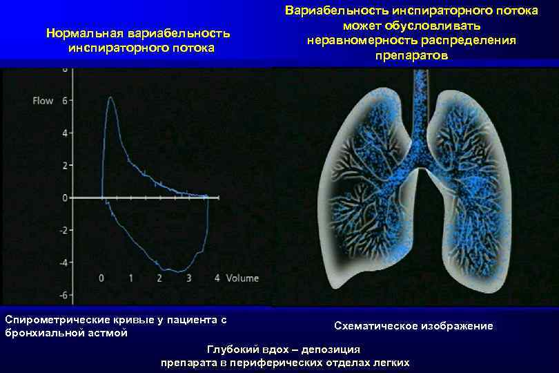 Нормальная вариабельность инспираторного потока Вариабельность инспираторного потока может обусловливать неравномерность распределения препаратов Спирометрические кривые