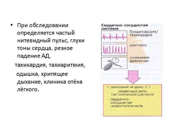 Характеристика пульса которая определяется на данном рисунке