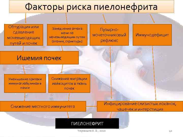 Факторы риска пиелонефрита Обтурация или сдавление мочевыводящих путей и почек Замедление оттока мочи по