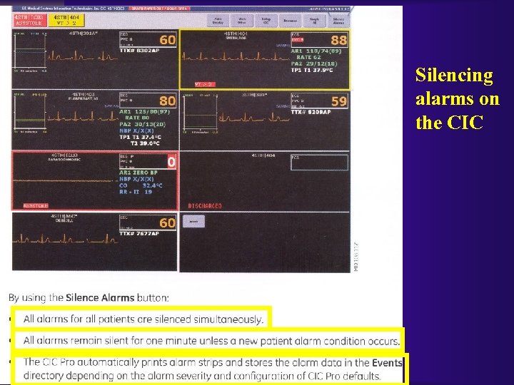 Silencing Alarms Silencing alarms on the CIC 