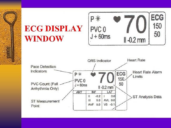 ECG DISPLAY WINDOW 