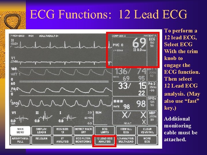 ECG Functions: 12 Lead ECG To perform a 12 lead ECG, Select ECG With