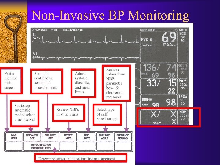 Non-Invasive BP Monitoring 