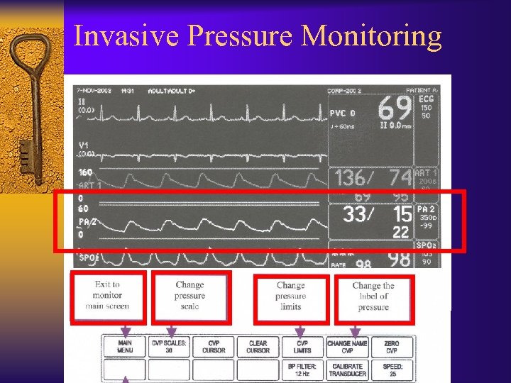 Invasive Pressure Monitoring 