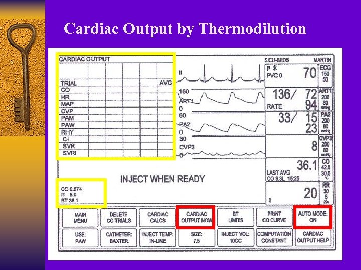 Cardiac Output by Thermodilution 