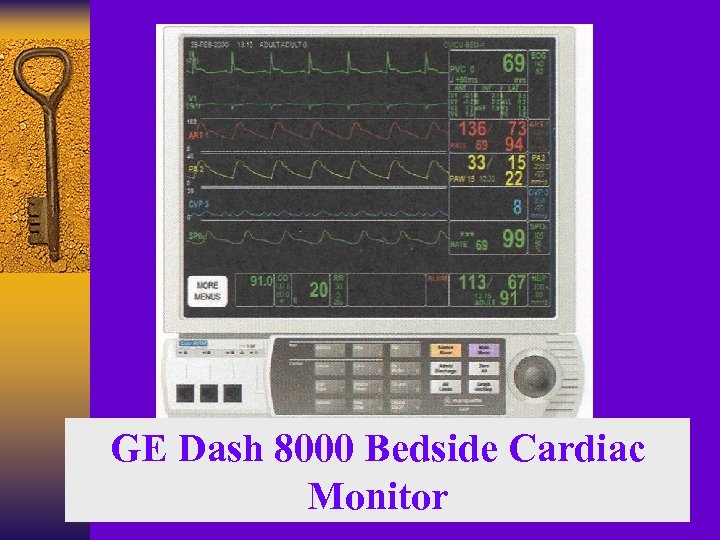 GE Dash 8000 Bedside Cardiac Monitor 