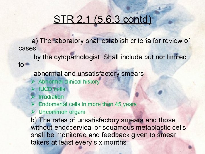 STR 2. 1 (5. 6. 3 contd) a) The laboratory shall establish criteria for