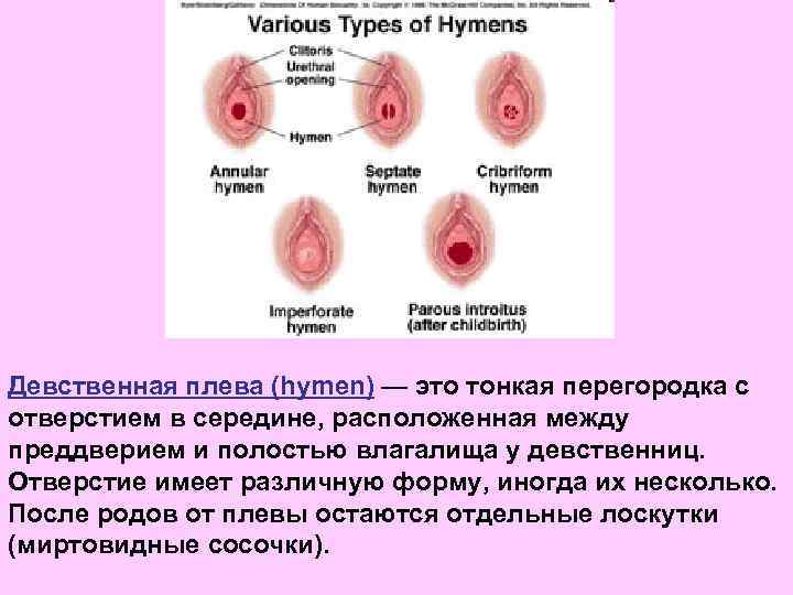 Девственная плева (hymen) — это тонкая перегородка с отверстием в середине, расположенная между преддверием