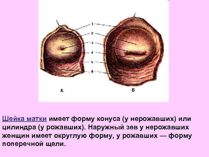 Шейка матки имеет форму конуса (у нерожавших) или цилиндра (у рожавших). Наружный зев у