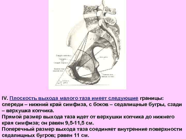 IV. Плоскость выхода малого таза имеет следующие границы: спереди – нижний край симфиза, с