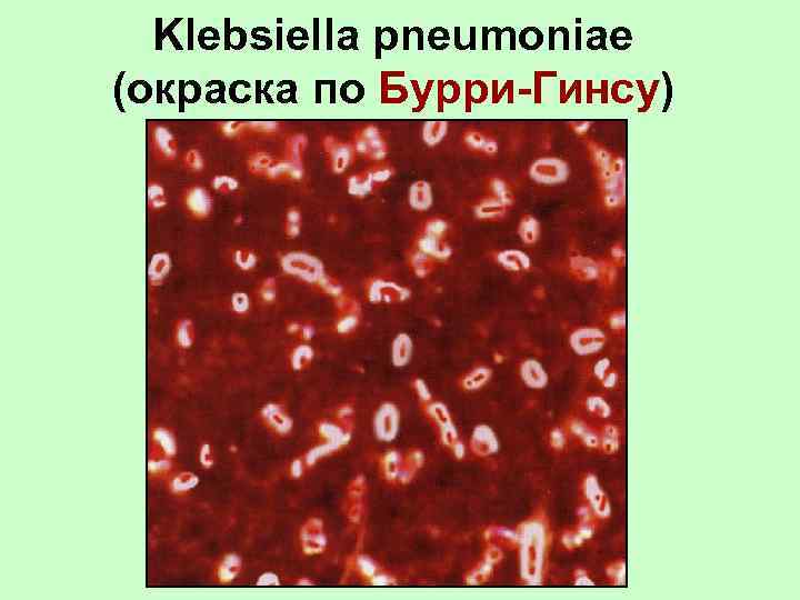 Klebsiella pneumoniae (окраска по Бурри-Гинсу) 