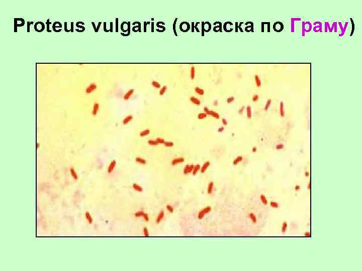Proteus vulgaris (окраска по Граму) 