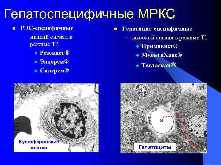 Гепатоспецифичные МРКС l РЭС-специфичные – низкий сигнал в режиме Т 2 l Резовист® l