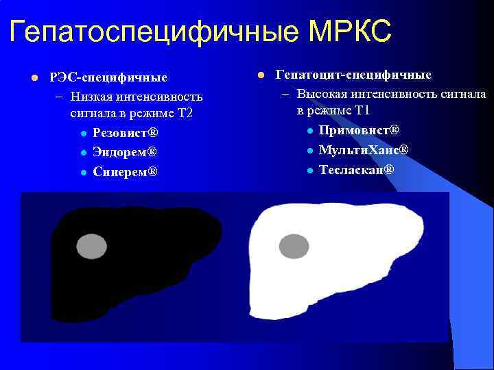 Гепатоспецифичные МРКС l РЭС-специфичные – Низкая интенсивность сигнала в режиме Т 2 l Резовист®