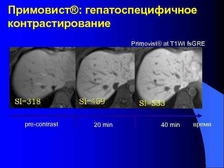 Примовист®: гепатоспецифичное контрастирование Primovist® at T 1 WI fs. GRE pre-contrast 20 min 40