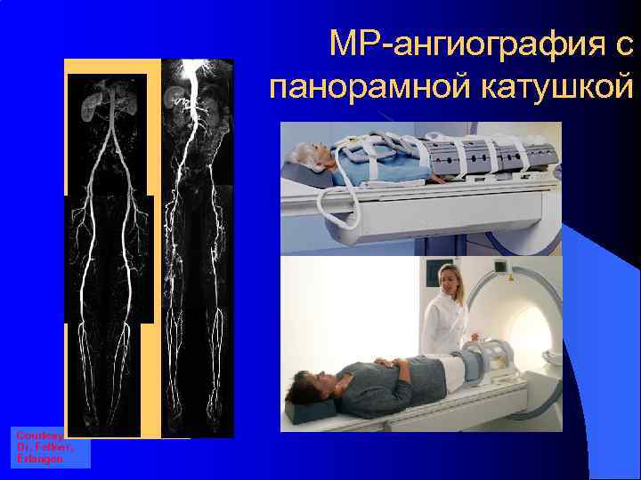 МР-ангиография с панорамной катушкой Courtesy Dr. Fellner, Erlangen 
