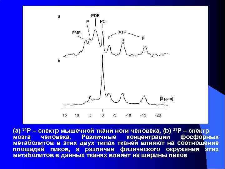 (а) 31 Р – спектр мышечной ткани ноги человека, (b) 31 Р – спектр