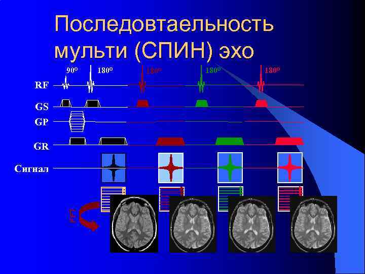 Последовтаельность мульти (СПИН) эхо 90° RF GS GP GR FFT Сигнал 180° 